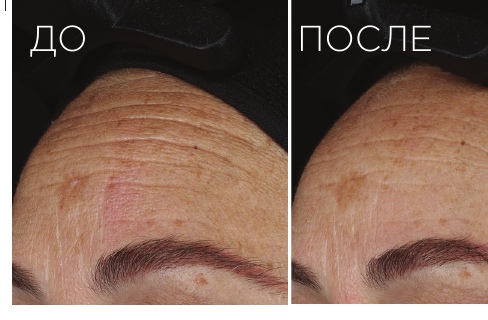 Возрастные изменения: результат до и после IMAGE Skincare
